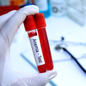 Anemia - blood testing in London