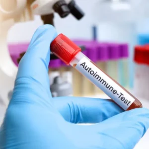 Autoimmune testing - blood testing in London