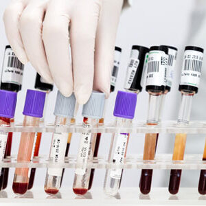 full heath check - blood testing in London