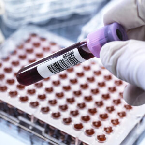 cancer related - blood testing in London