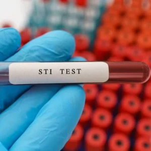 sti's - blood testing in London