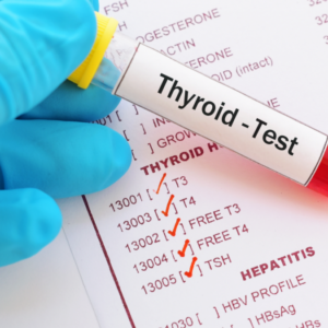 thyroid health - blood testing in London