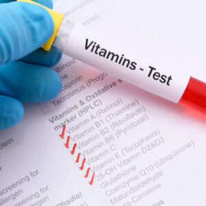 Vitamin minerals - blood testing in London