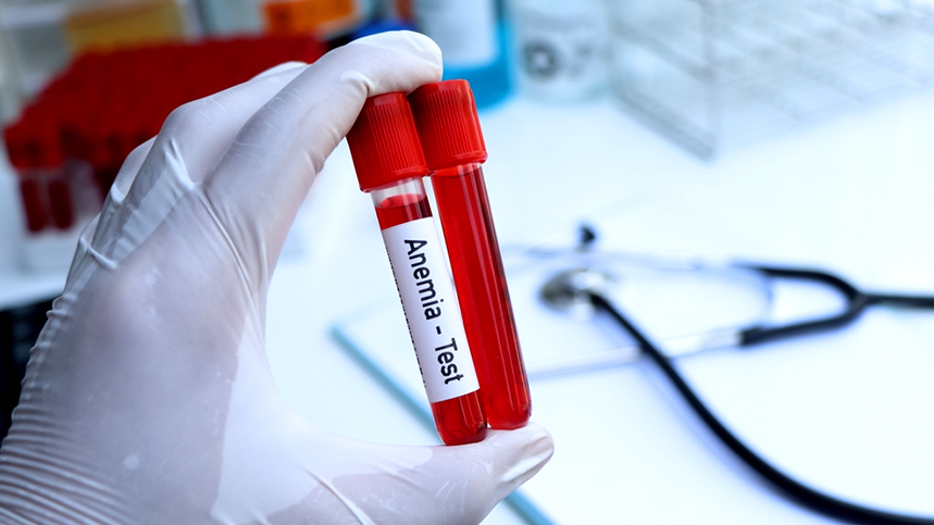 Glucose-6 Phosphate Dehydrogenase (G6PD)