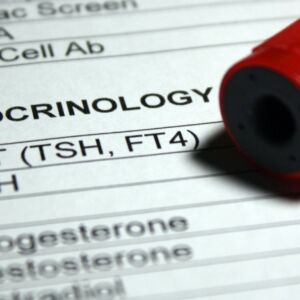 17-OH Progesterone (17 OH PRG)