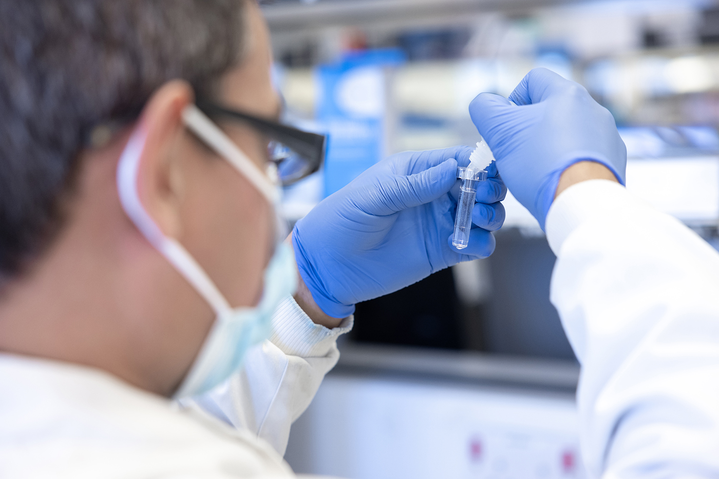 Rapid Plasma Reagin (RPR)