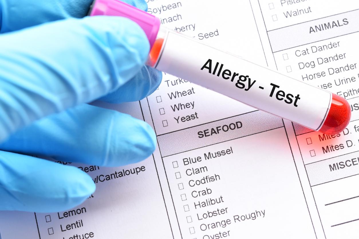 Allergy Profile VI (30) Atopic